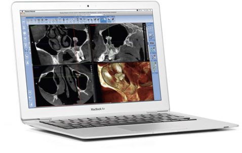 Как открыть и прочитать диски КТ и МРТ?